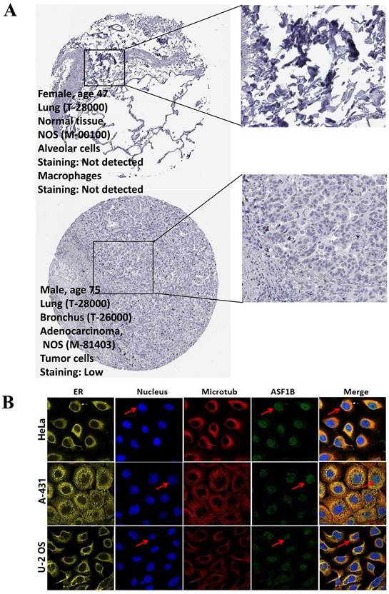 J Cancer Image