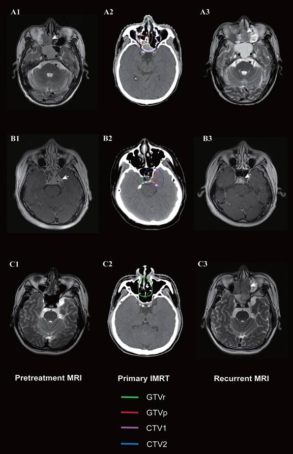 J Cancer Image