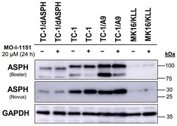 J Cancer Image