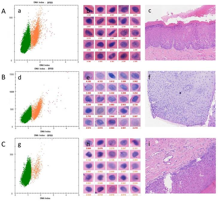 J Cancer Image