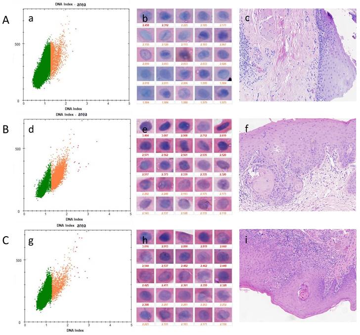 J Cancer Image