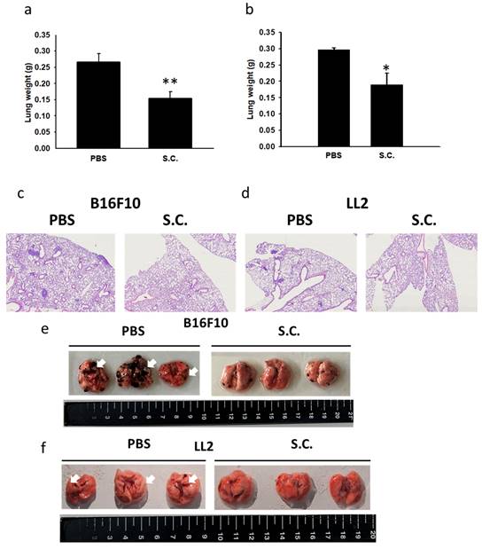 J Cancer Image