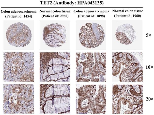 J Cancer Image