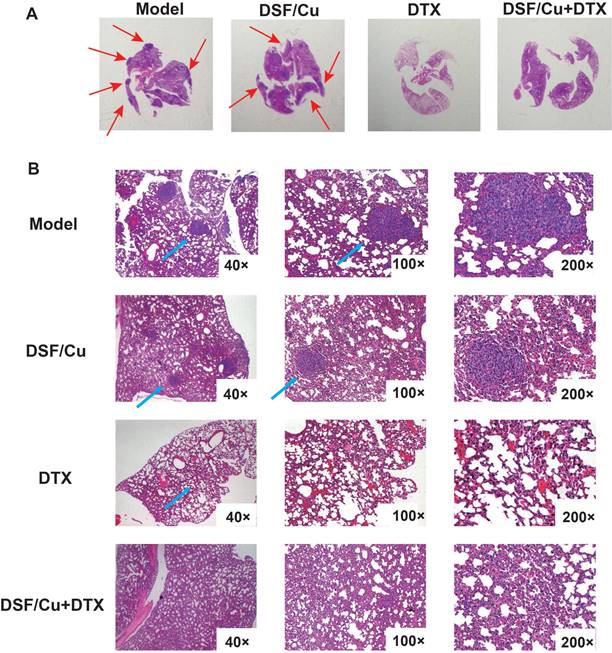 J Cancer Image