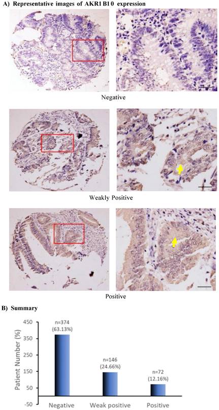 J Cancer Image