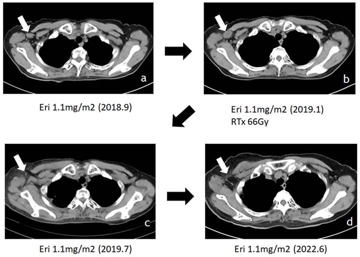 J Cancer Image