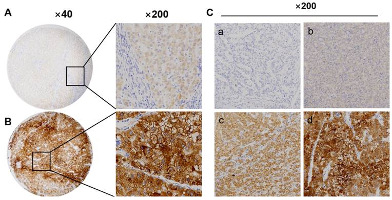 J Cancer Image