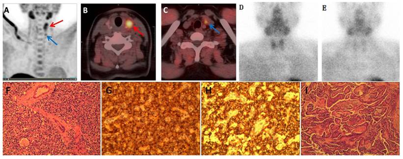 J Cancer Image