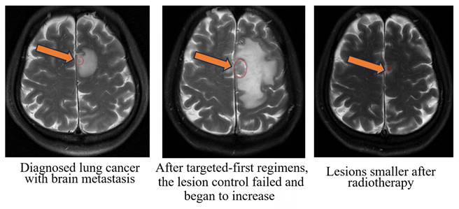 J Cancer Image