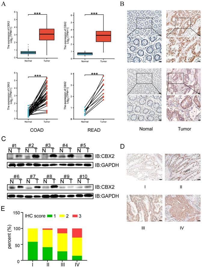 J Cancer Image