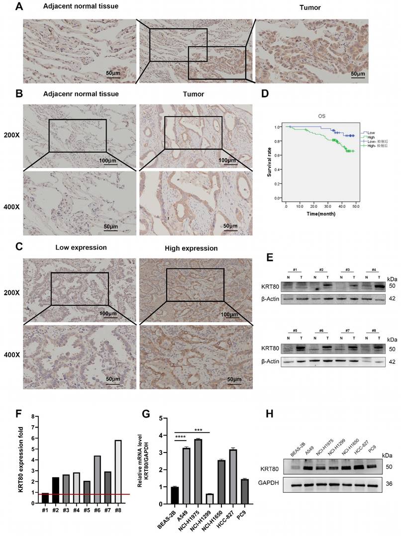 J Cancer Image