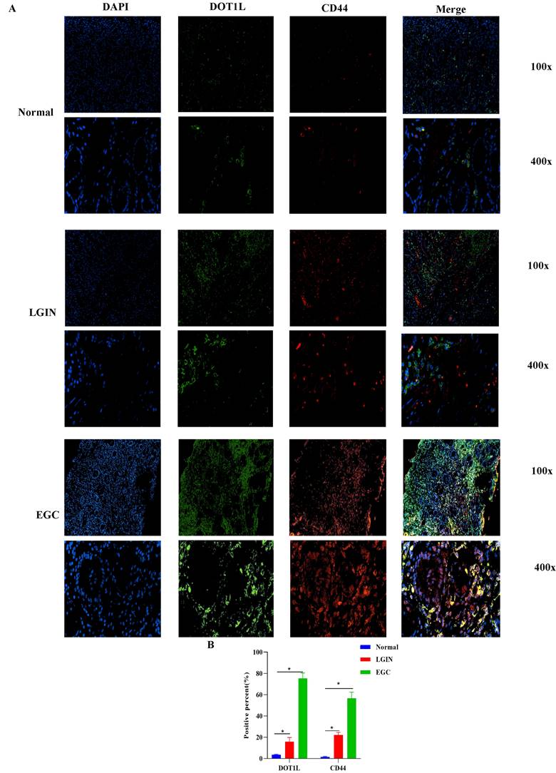 J Cancer Image