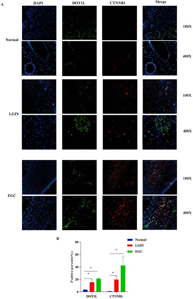 J Cancer Image