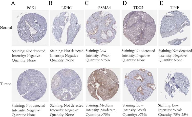 J Cancer Image