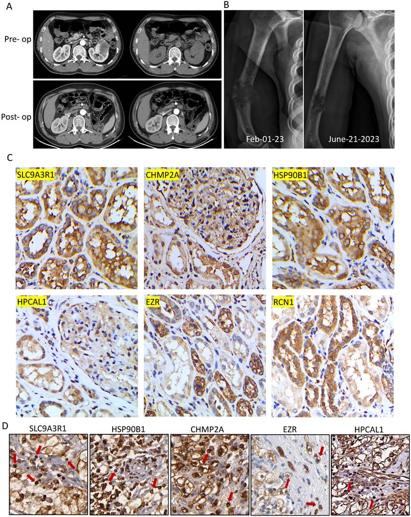 J Cancer Image