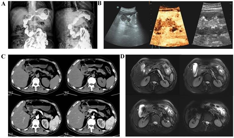 J Cancer Image