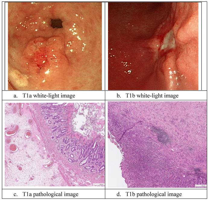 J Cancer Image