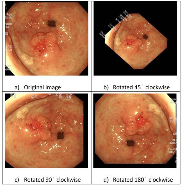 J Cancer Image