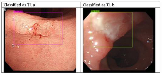 J Cancer Image