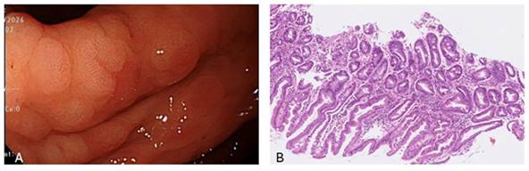 J Cancer Image