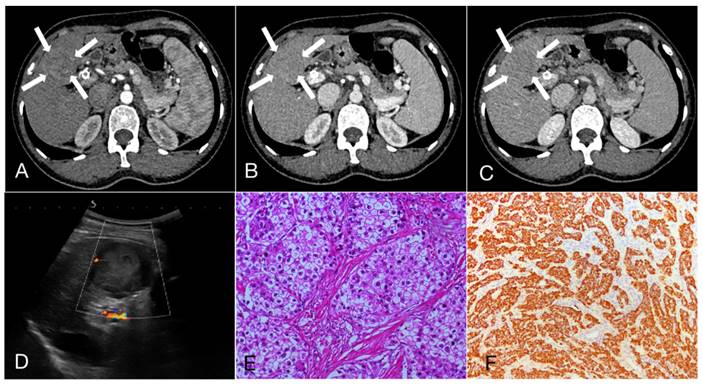 J Cancer Image