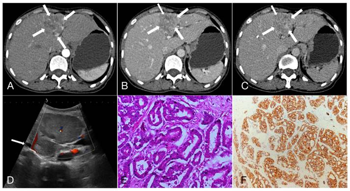 J Cancer Image