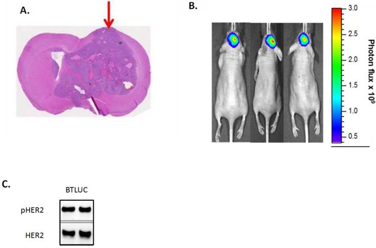 Antitumor Activity of TAK-285, an Investigational, Non-Pgp Substrate