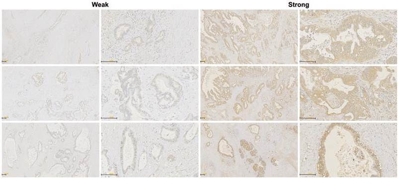 J Cancer Image