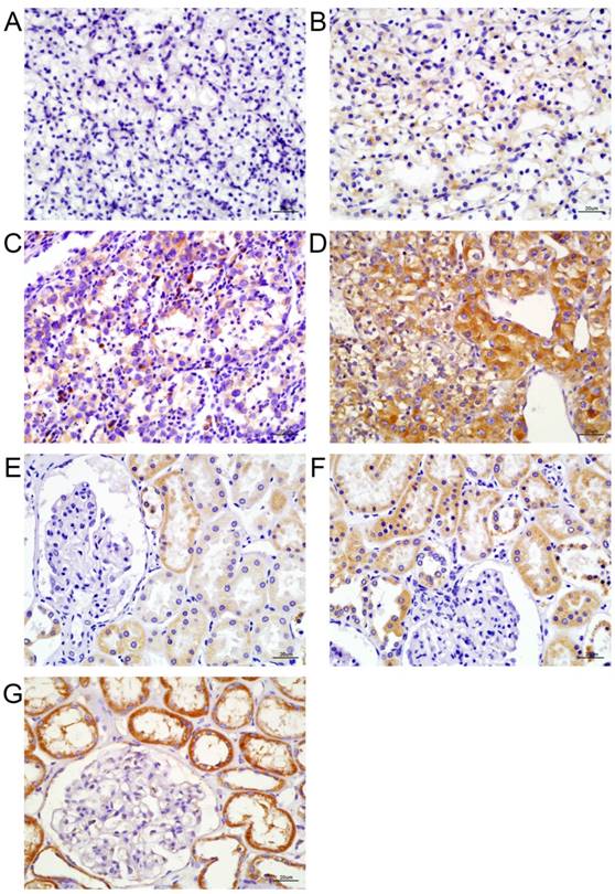 J Cancer Image