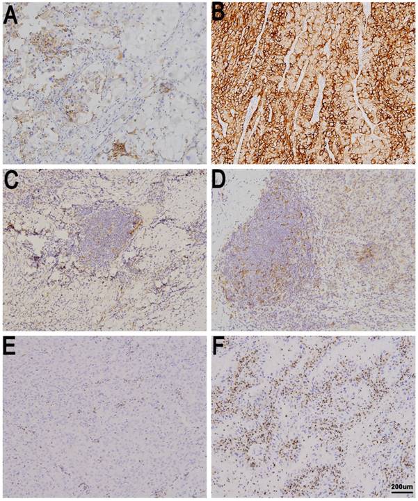 J Cancer Image