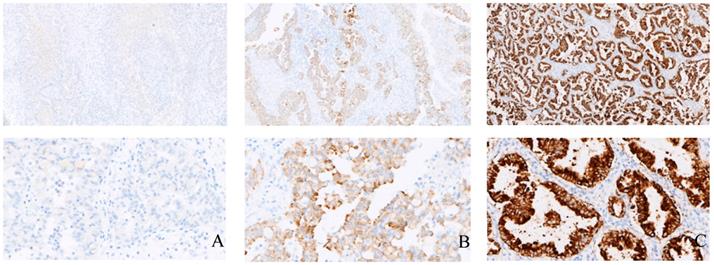 J Cancer Image