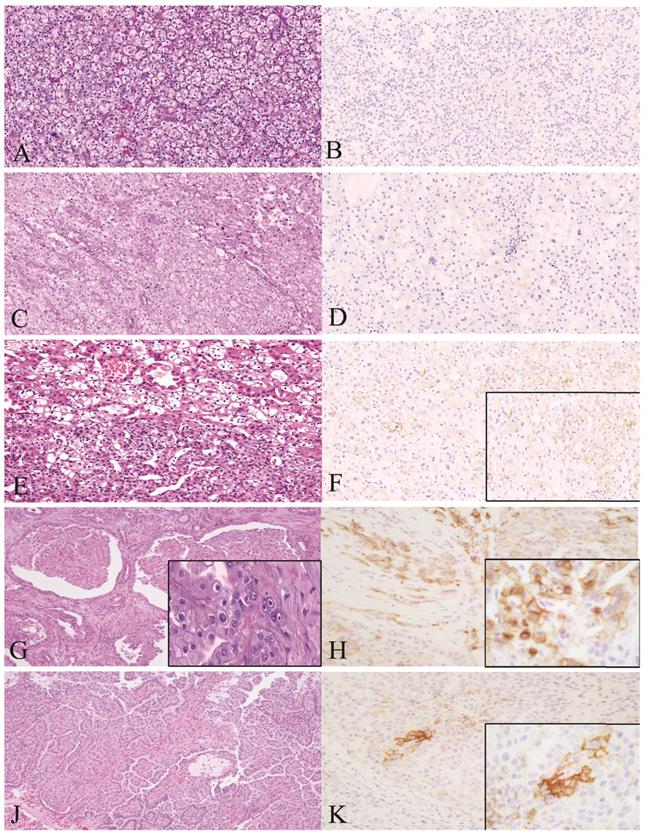 J Cancer Image