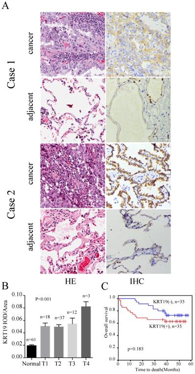 J Cancer Image