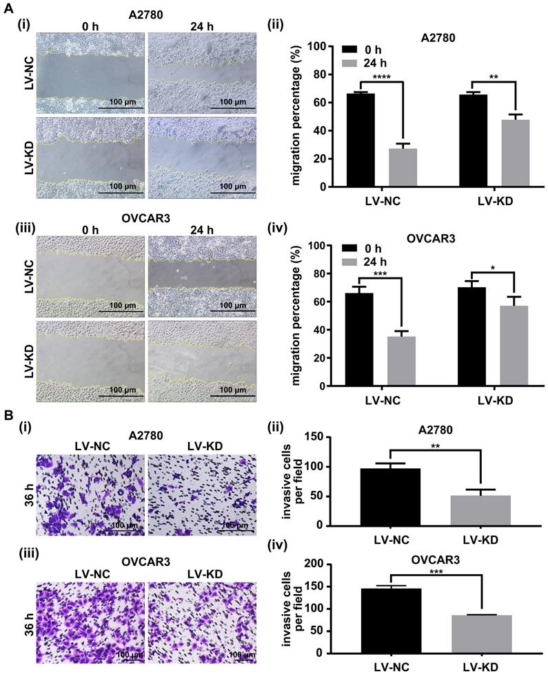 Long Non Coding Rna Snhg25 Promotes Epithelial Ovarian Cancer Progression By Up Regulating Comp