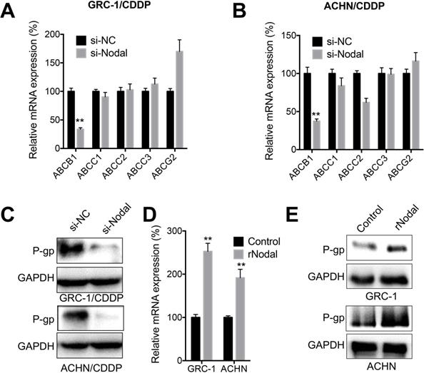 Nodal Is Involved In Chemoresistance Of Renal Cell Carcinoma Cells Via Regulation Of Abcb1