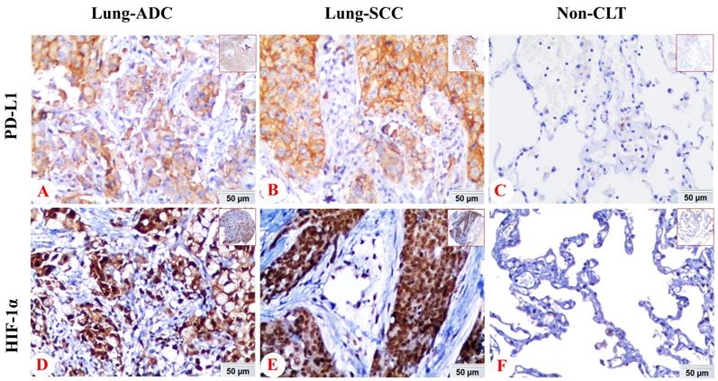 J Cancer Image