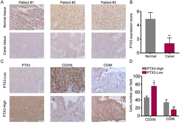 J Cancer Image