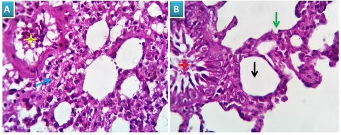 J Cancer Image