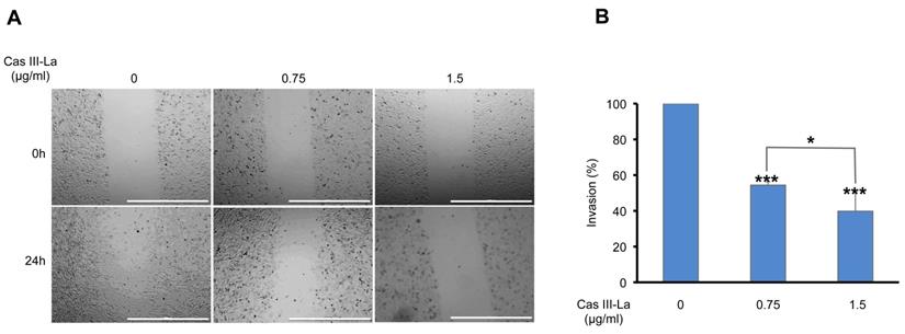 J Cancer Image
