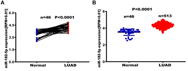 Role of MMP-9 in epithelial-mesenchymal transition of thyroid cancer, World Journal of Surgical Oncology