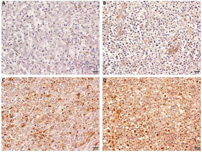 J Cancer Image