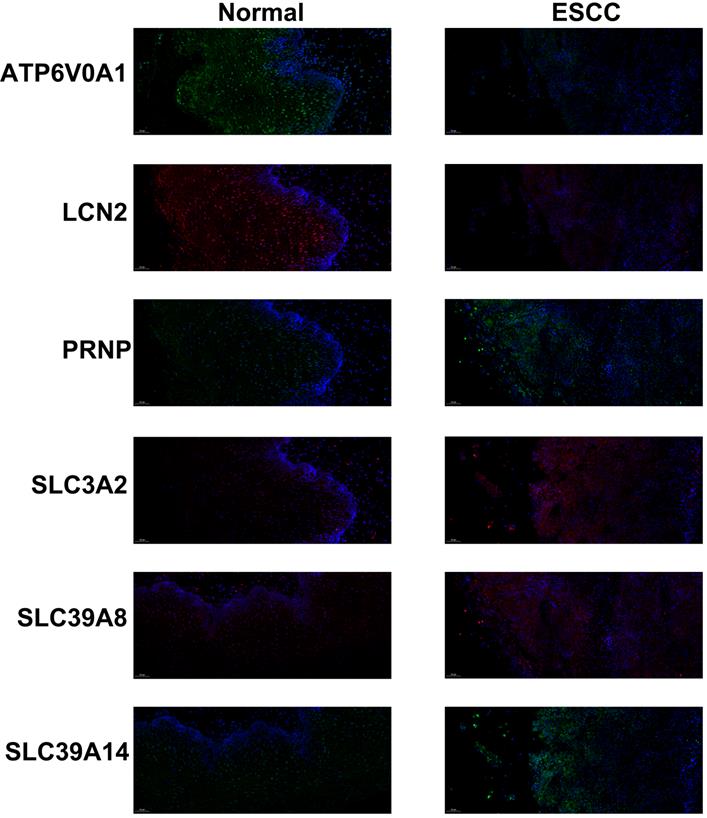 J Cancer Image