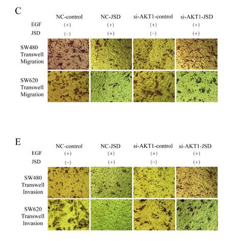 Jiedu Sangen Decoction Reverses Epithelial-to-mesenchymal Transition ...