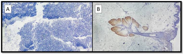 J Cancer Image