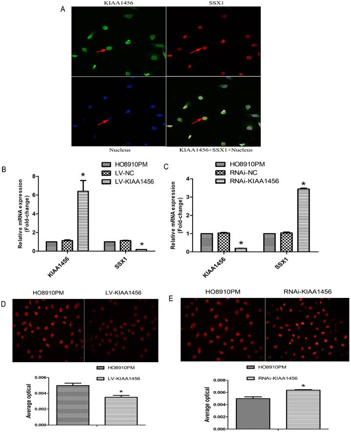 J Cancer Image