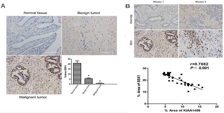 J Cancer Image
