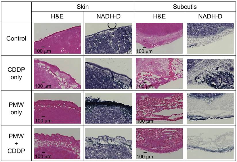 J Cancer Image