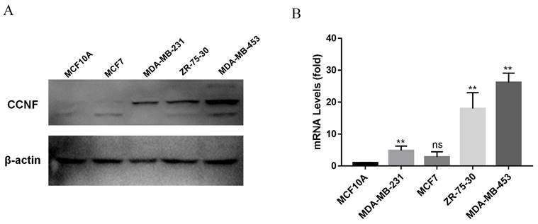 J Cancer Image