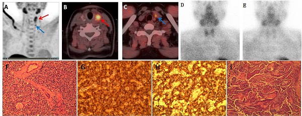 Comparative Analysis of Diagnostic Efficacy in Primary ...