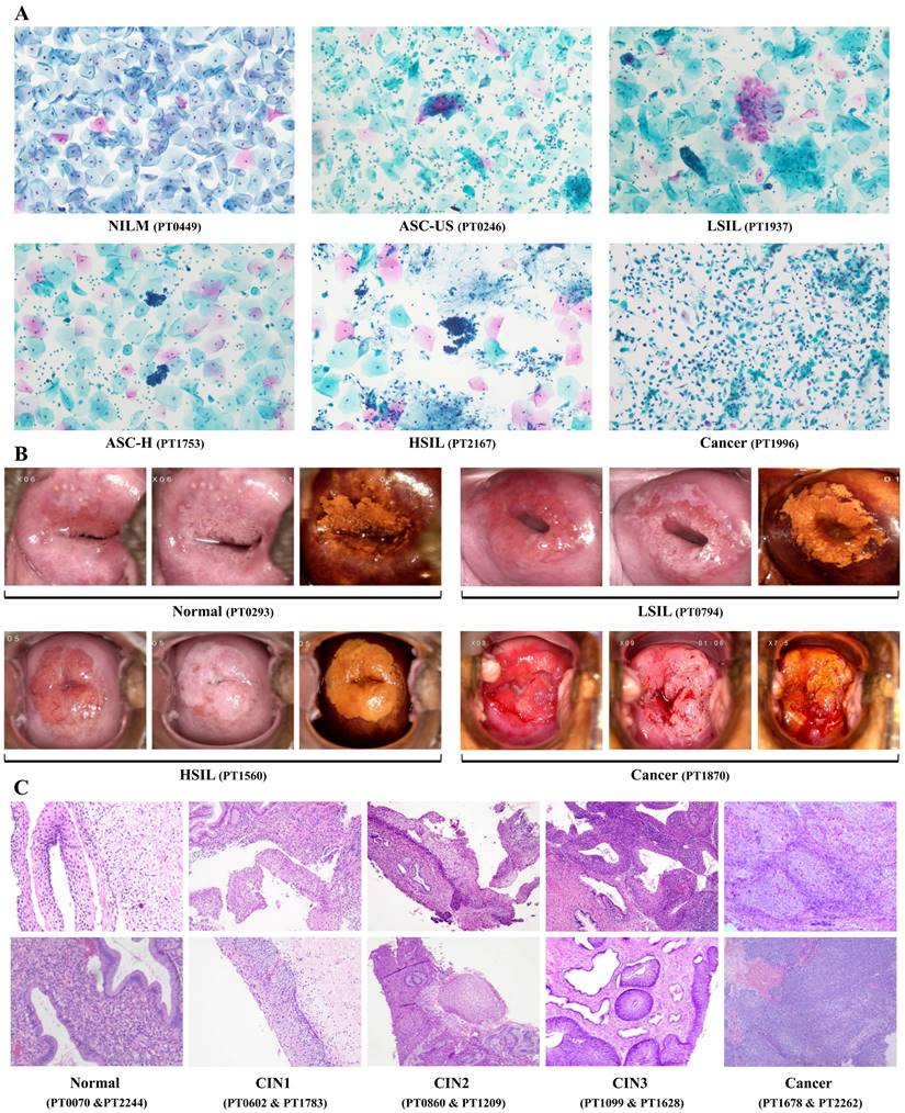J Cancer Image